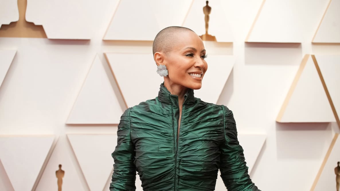 Oscars Controversy Sheds Light on the Struggle of Female Hair Loss