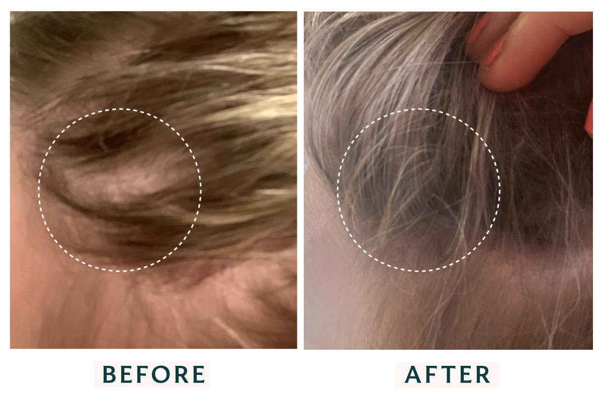 Before and After Damaged Hair: Victoria's Story