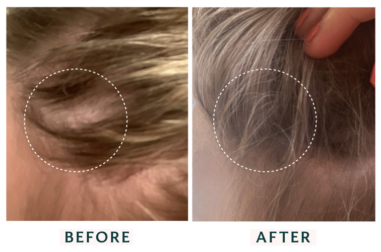 Before and After Damaged Hair: Victoria's Story