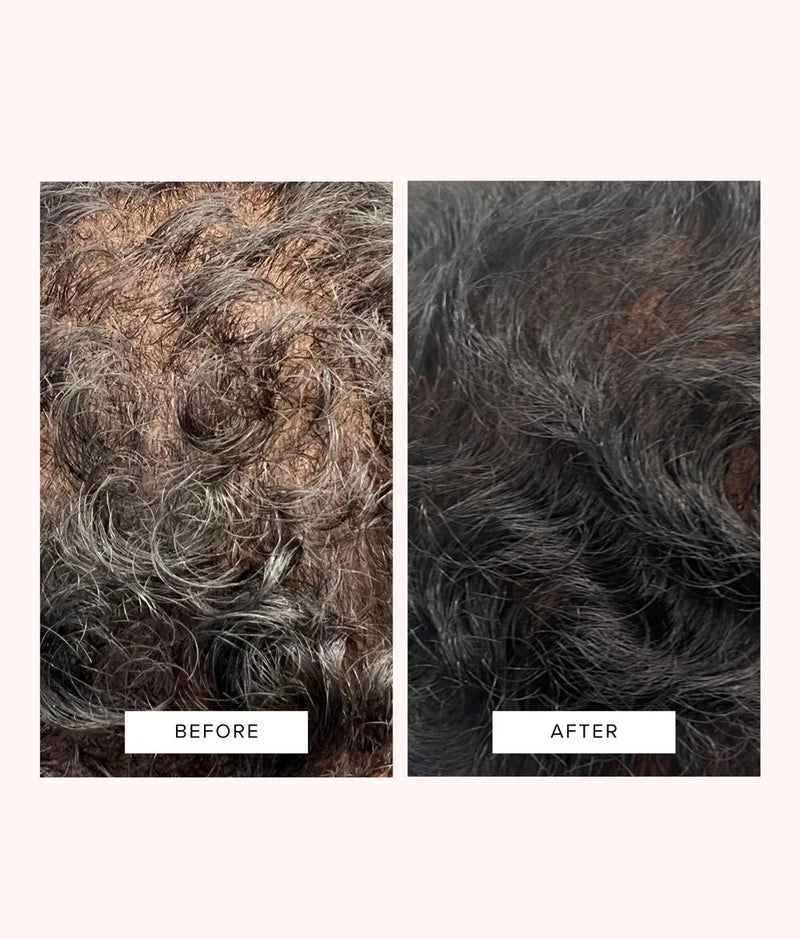 Close-up comparison of scalp with thinning, dry hair before and thicker, healthier hair after treatment