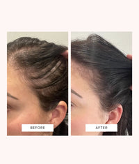 Side-by-side comparison of a woman's dark hair showing increased density and restoration after treatment