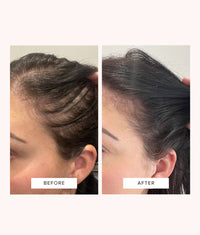 Motherhood Hair Density & Restoration System