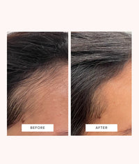 Before and after close-up of scalp showing improved hair density and nourishment