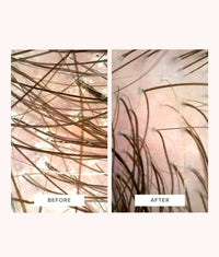 Close-up comparison of scalp and hair strands before and after treatment, showing clearer scalp and healthier hair